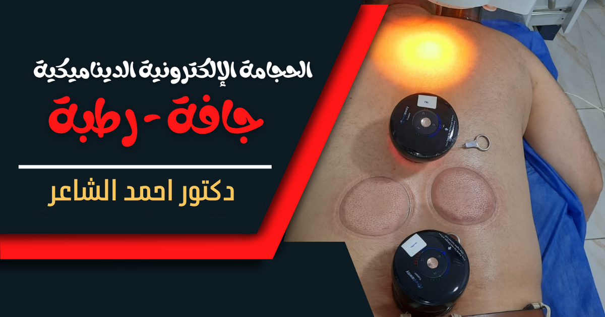 الحجامة الإلكترونية