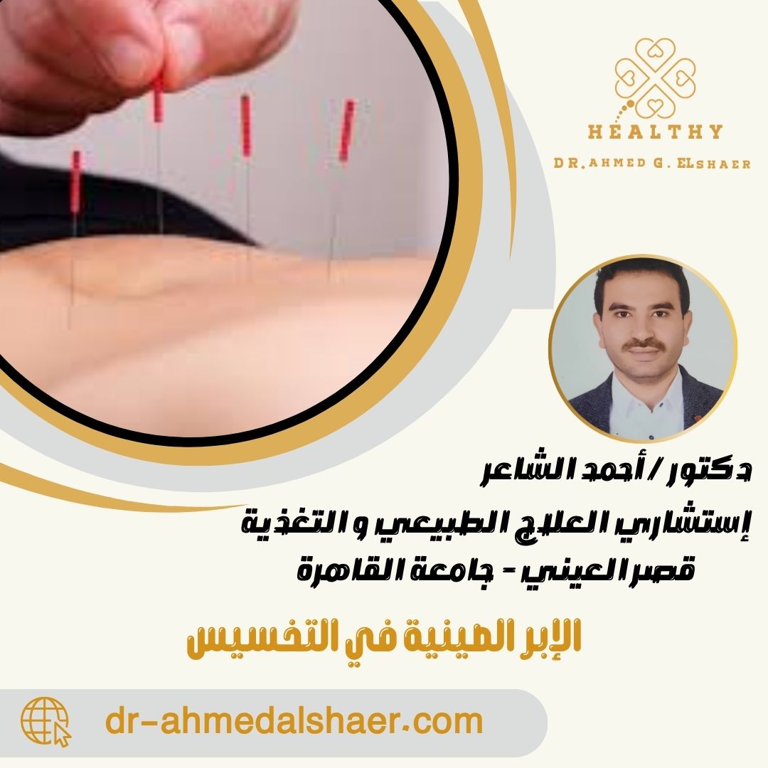 الإبر الصينية في التخسيس