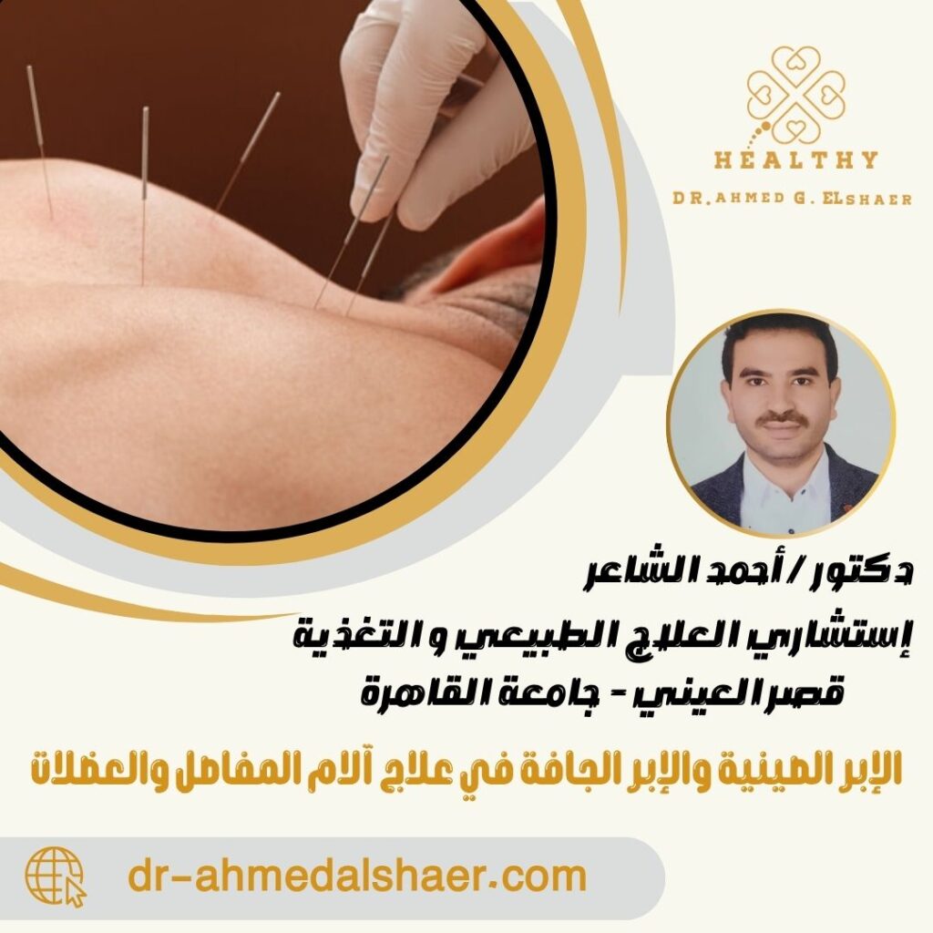 الإبر الصينية والإبر الجافة في علاج آلام المفاصل والعضلات