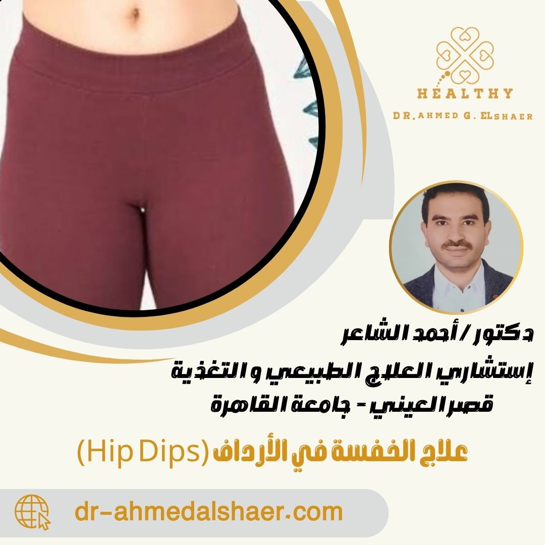 علاج الخفسة في الأرداف (Hip Dips)