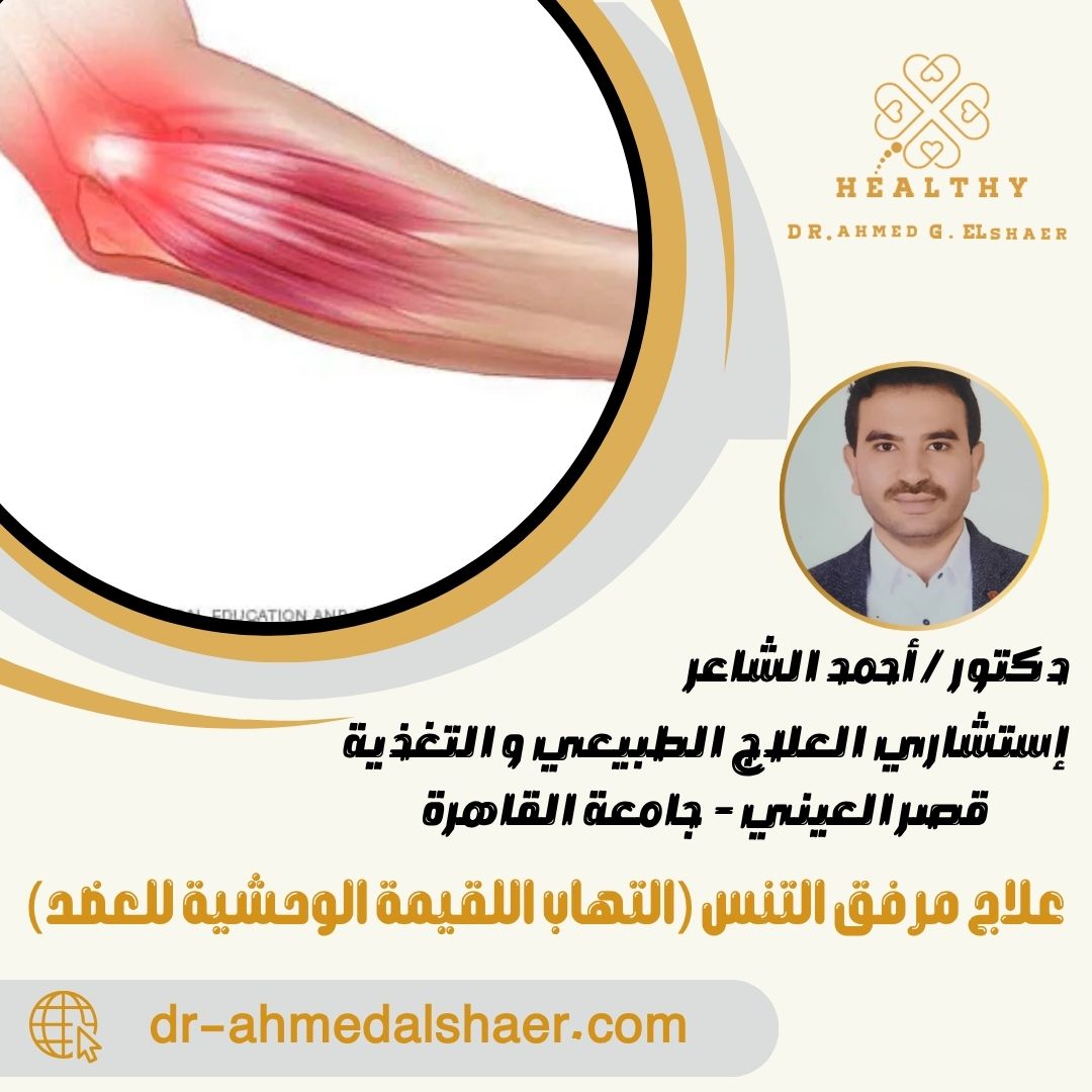 علاج مرفق التنس (التهاب اللقيمة الوحشية للعضد)