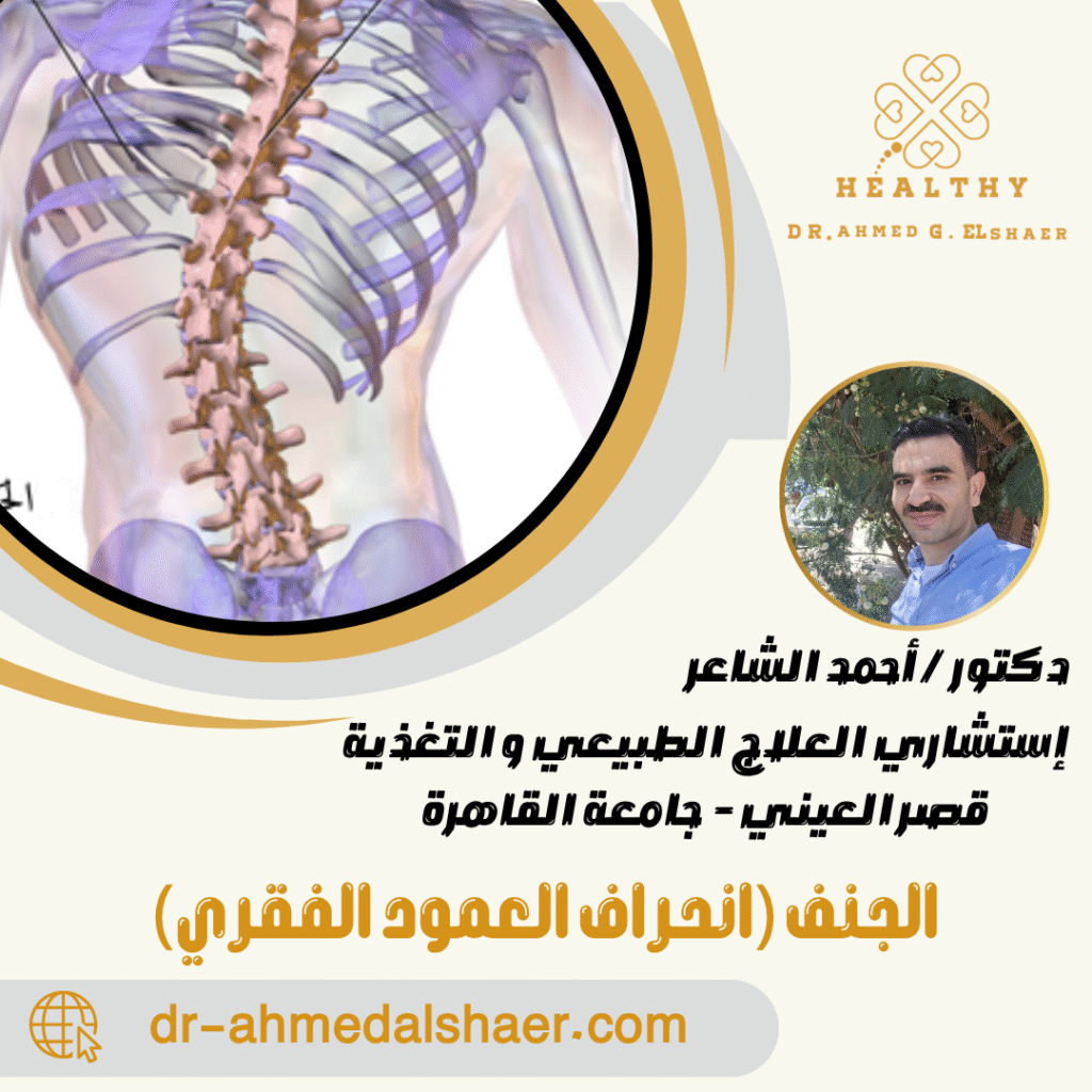 الجنف (انحراف العمود الفقري)