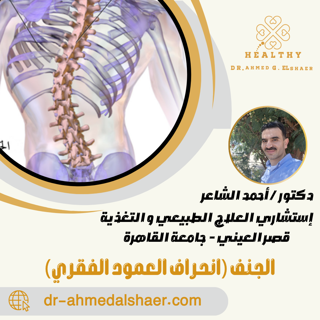 الجنف (انحراف العمود الفقري)
