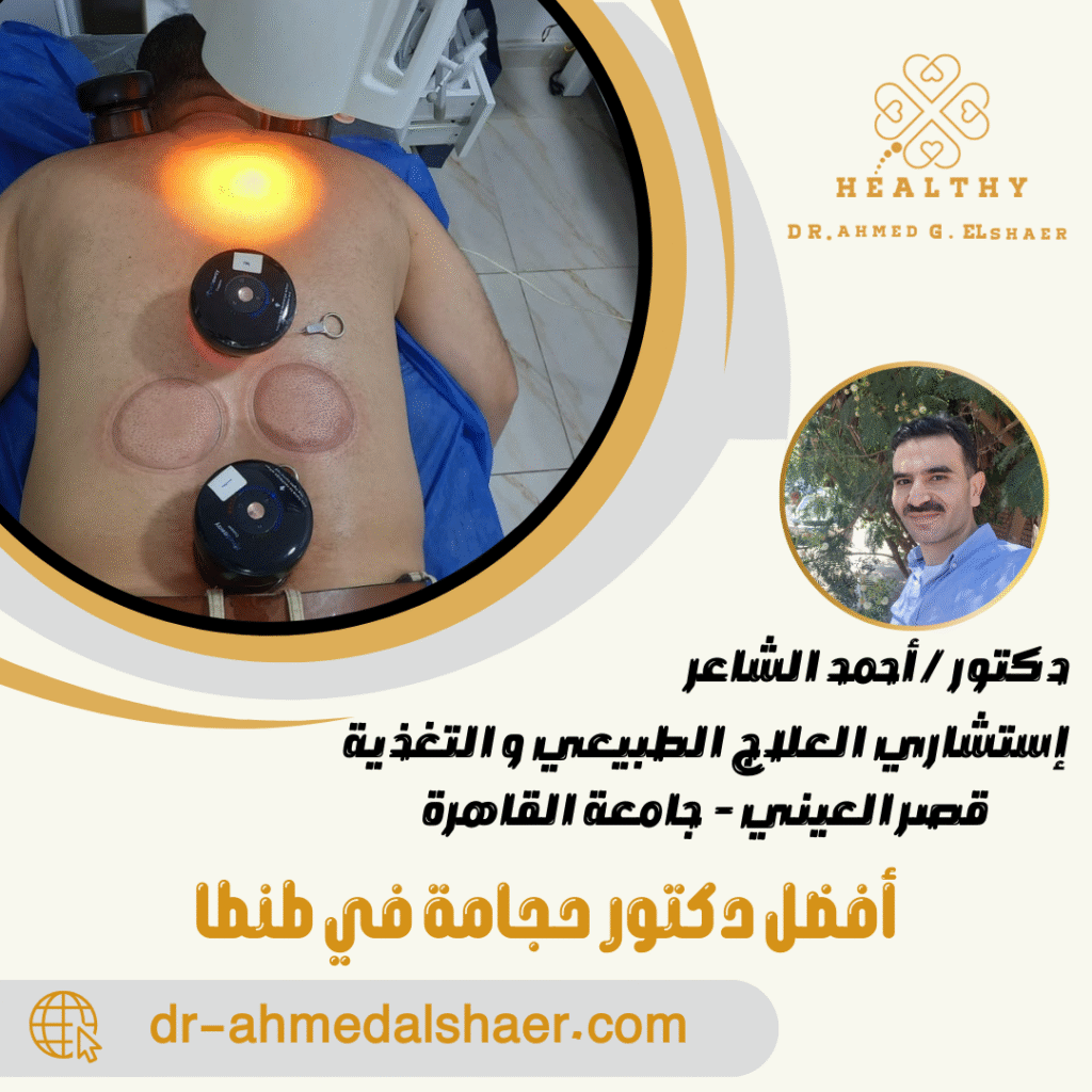 أفضل دكتور حجامة في طنطا
