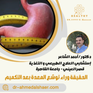  الحقيقة وراء توسّع المعدة بعد التكميم