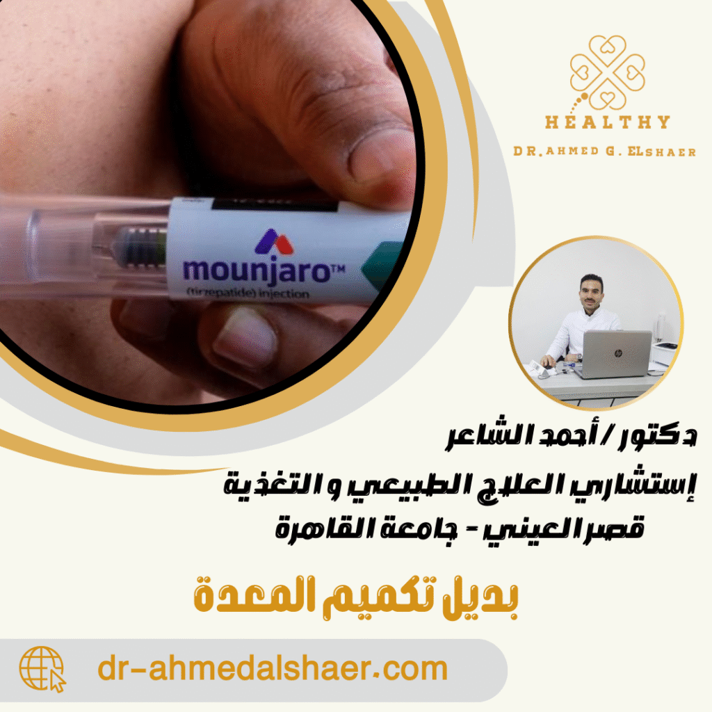 بديل تكميم المعدة